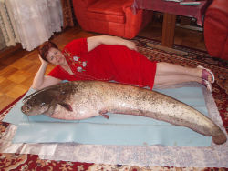 realmonstrosities:  Proud ex-mermaid poses with her “other half” after successful surgery.