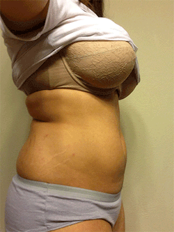 fatterandoutofshape:  I couldn’t decide which ones to post so I posted them all! It takes some effort to suck in my belly like this. I look significantly more thin but my belly still overhangs a bit. Must be all the chub. I wonder at what weight will