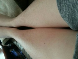 kbunks:  Welp, these are my hairy legs. These