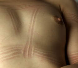 Rope Marks.