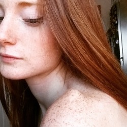 freckled-girls-fan:  http://freckled-girls-fan.tumblr.com