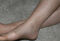 Nice arches, but hairy legs in nylons are