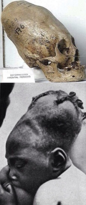 sixpenceee:  jackthemother:  sixpenceee:  zooanthropy:  sixpenceee:  MANGBETU TRIBE AND SKULL ELONGATION Here’s something intense. The Mangbetu tribe elongated their skulls. The custom is called Lipombo. It was a status and beauty symbol but the Belgian