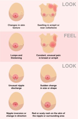 vaneloslash:  geekymedguru: How to spot signs and symptoms of Breast Cancer   Reblog to literally save a life 