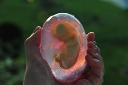standpoor:  sixpenceee:  When people see the image of a human fetus, they often associate it with abortion and the warring political perspectives that come with that issue. But to artist and entrepreneur Lily Su, the image of an unborn baby symbolizes