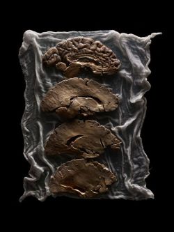 Malformed – A Collection of Human Brains from the Texas State Mental Hospital - Adam Vorhees