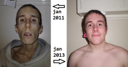 thinspiration-to-be-fit:  sleepingwithpheels:  smilelikeitdidnthurt:  neuusex:  rexaverno:  stagnant-n:  syn-shadz:  so here is my anorexia 2 year recovery in a photo. i have looked similar to the picture on the right for a while now, i have been healthy