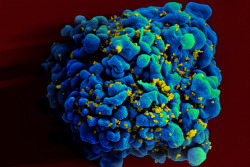 mindblowingscience:  A random genetic mutation has made HIV harmless in two patients  French researchers have pinpointed a genetic mutation that has resulted in two men showing no symptoms or clinical traces of HIV, despite being infected by the virus