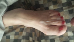 frostedfeet:  My wife’s frosted feet 