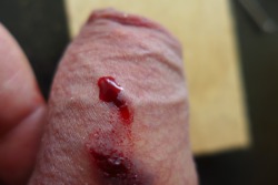 my bleeding cock