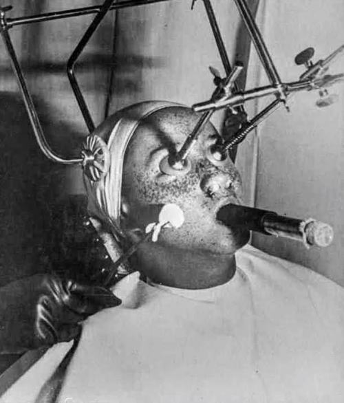 Anti-Freckle Treatment in the U.S 1933https://painted-face.com/