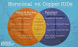 smithpse:pplm:Get the facts - here’s what you should know about hormonal vs. copper IUDs (IntraUterine Device)(left=copper, right=hormonal) (IUD location in body)