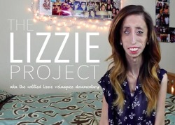 the-ugly-naked-guy:  I really hope you have 5 minutes to read this. Some of you may know Lizzie Velásquez. She has a very rare condition that only two other people is known to have. It means that she has zero body fat% she’s also blind on one eye and