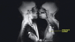 supascoopaandmightyscoop:  MRI Footage Shows What’s Happening Inside Your Body#xraylove source: http://www.oystermag.com/mri-footage-shows-whats-happening-inside-your-body-nsfw/
