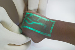 toastyhat:noravon:  sixpenceee:VeinViewer: an infrared device that detects the location of a patient’s veins and projects them on the skin so doctors and nurses don’t miss. It was developed by the Christie Medical Holdings company. They mainly show