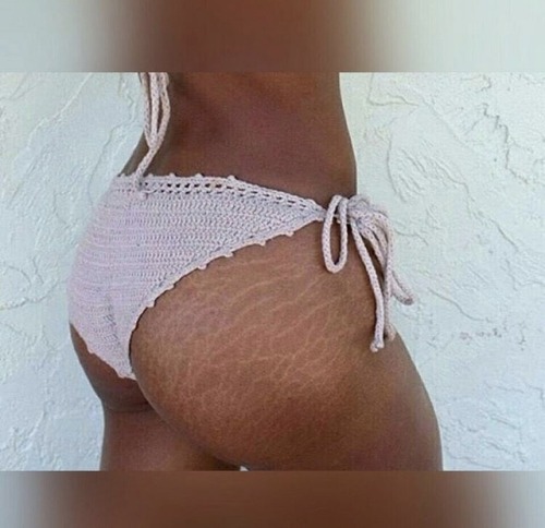 Sex mahoganypeople:  Ode to the stretch marks pictures