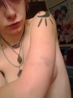 sugar-tentacles:  Dang that bruise thanks Brent xp 