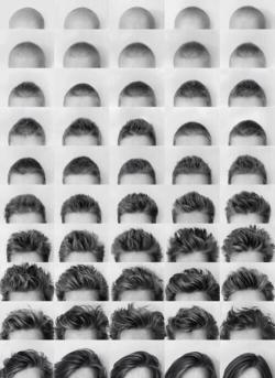just-a-penis-with-a-dream:shredtheaqua:theworrldisugly:This woman photographed her hair growing back after chemo and I think it’s the most amazing thing to look at. This lady has my upmost respectI will never not reblog.  At first I thought it was an