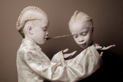 greenayy: sixpenceee:  Lara and Mara Bawar are not your average supermodels, but their striking appearance is sending shockwaves through the fashion industry. The 11-year-old twins from São Paulo, Brazil, have albinism, a condition that causes a lack