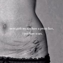 suicidelittlegirl:  &ldquo;We all have scars. The difference is that they are on my skin.”