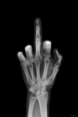 da skeleton finger