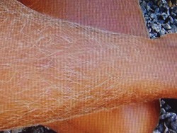 smwarley:  No words!   This type of leg hair