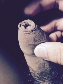 erikforeskin:  bb-or-not-bb:  I’ve stretched my foreskin:) feel like it’s getting longer!  Keep on stretching that snouty cocksure!Erik
