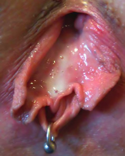 pussymodsgalore  Just fucked pussy with a VCH piercing and ring. 