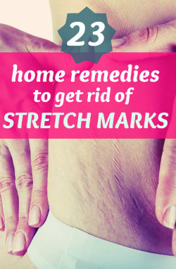 homeremedyhacks:23 Effective Home Remedies