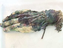 &ldquo;Tthe hand that never stopped painting &rdquo; Morten Viskum used a hand from a corpse as a paint brush. 