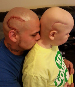 sixpenceee:  Dad gets a tattoo of son’s surgery scar to help his self confidence Fighting a brain tumor obviously wasn’t easy for 8-year-old Garbiel Marshall, what his surgery left behind presented him with a new battle. His father, 28-year-old Josh