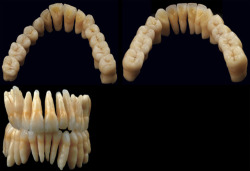 full set of mature human teeth.