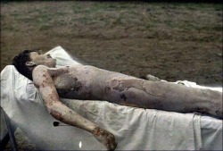GRAPHIC! The individual is a French soldier of the 99th Infantry Regiment, who was killed by a German mustard gas attack. Besides burning his lungs and intoxicating him, the gas also tore his skin down several layers. His death was probably excruciatingly