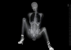 asgardreid:  spinesaw:  the-butt-prince-ike:  scienceisbeauty:  This is a classic `nude calendar´ when you extract everything which transparent to X-Rays, i.e. all the flesh, and therefore any remaining sensuality. Via Tha Mary Sue: “This Exists: X-Ray