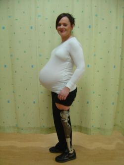 tau-01:  amputee SAK pregnant   This Woman is Amazing