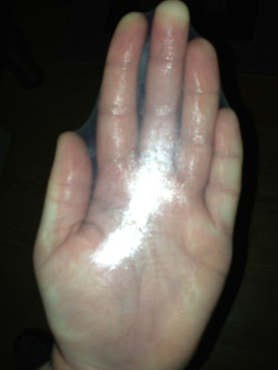 My hand fits in a condom.