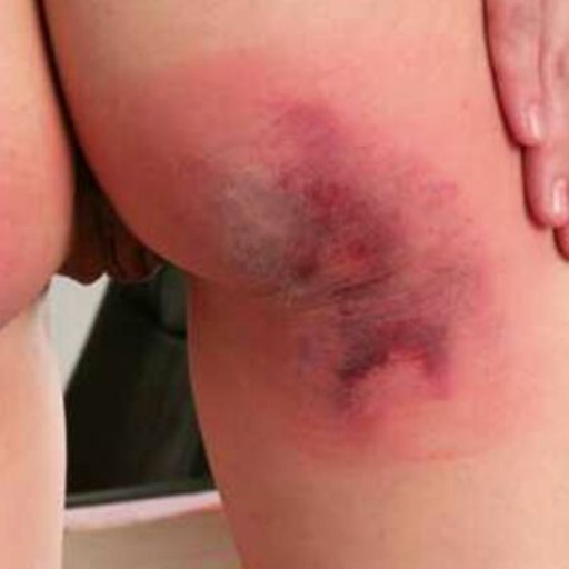 Sex mr-filthy-torture:  Tietmarteling….  pictures