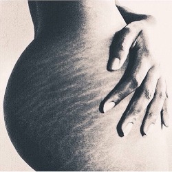 supremeartdealer:  The stretch marks of a black woman. Taken by Trill Americana