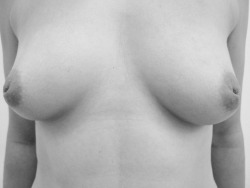 piercing-j:  londonpiercingclinic:  Inverted nipple piercing  Love.
