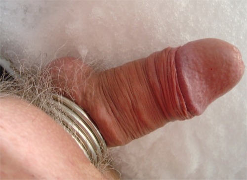 Sex in snow foreskin removed pictures
