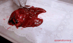 perkachurr:  cannabiskitties:  Holy shit our lungs are crazy   these are cats lungs actually