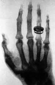 the-new-luna:dj-froge:sixpenceee:First Human X-ray 1896. The woman, Marie Curie, who took part in this experiment had so many X-rays taken that she developed a form of blood cancer and died.Took part? TOOK PART????? SHE FUCKIN INVENTED THAT SHIT WITH