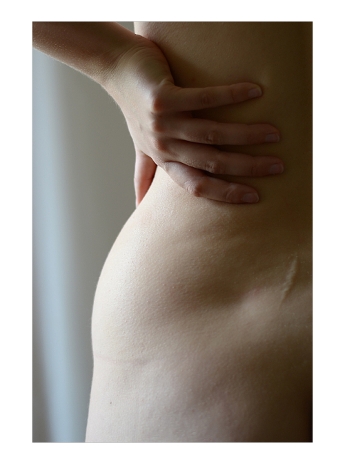 wolfundermyskin-deactivated2014:  These photos show parts of myself I don’t always love; my hips, the scar on my back, all the painful impressions clothes leave on my skin because I’m not thin, the callous skin of my elbows, my stretch marks, body