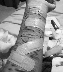 worthless-depressed:  forever-tainted:  b&amp;w selfharm   **Warning - This blog is triggering**