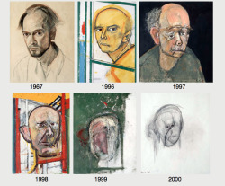 An artist with Alzheimer’s drawing self-portraits.this is sad and beautiful bye William Utermohlen