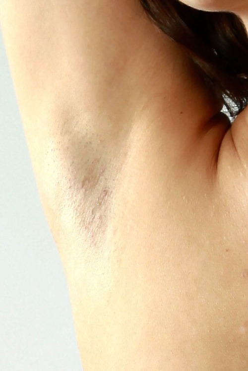 sensualarmpits:  Armpit Closeup  Ummmm more porn pictures