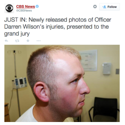 moontomoe:  rock-lee:  look at all those injuries   how did he survive……..  Here&rsquo;s the real injury you fucking piece of shit Darren Wilson