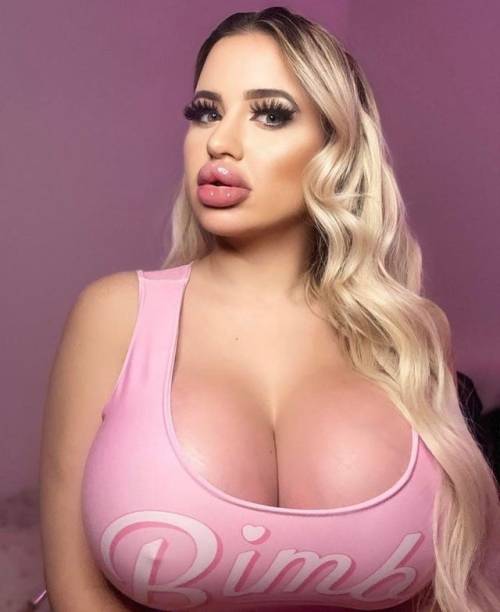 crashlovesbimbos:  realwomengetplasticsurgery:Huge fake cleavage just looks better. Massive injected duck lips just look better. Get plastic surgery, become sexy. It’s not complicated. Absolute queen. I knew she was going big but when I saw those saline