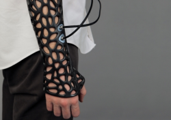 Designersofthings:   3D Printed Cast Design Heals Patients 40% Faster A Turkish Student