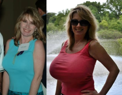 The gorgeous Nancy Quill, before and after her breast augmentation.Â Nancy didnâ€™t have small tits to begin with, but decided to get absolutely massive implants. Her current size is unknown.&ndash;Keep the boobies growing! Support Boob Growth on Patreon